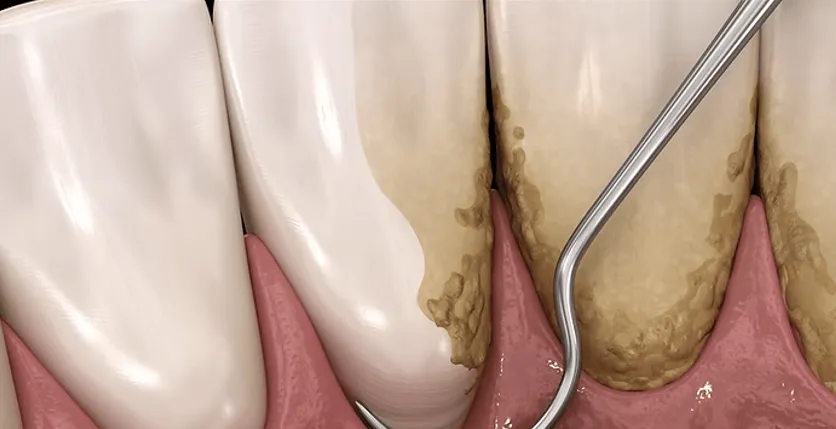 How the Best Dentist in Temecula Supports the Comfort, Confidence, and Long-Term Oral Health of Seniors