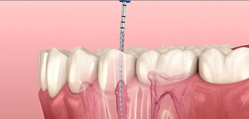 How the Best Dentist in Temecula Supports the Comfort, Confidence, and Long-Term Oral Health of Seniors